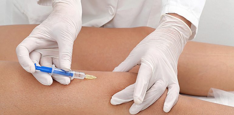 Mesoterapia para Analgesia