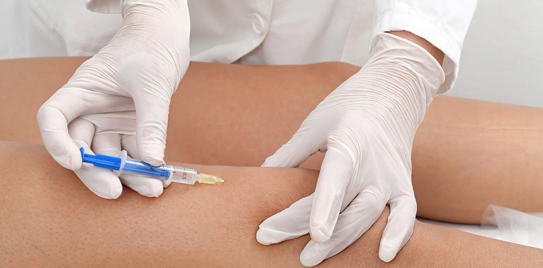 Mesoterapia para Analgesia